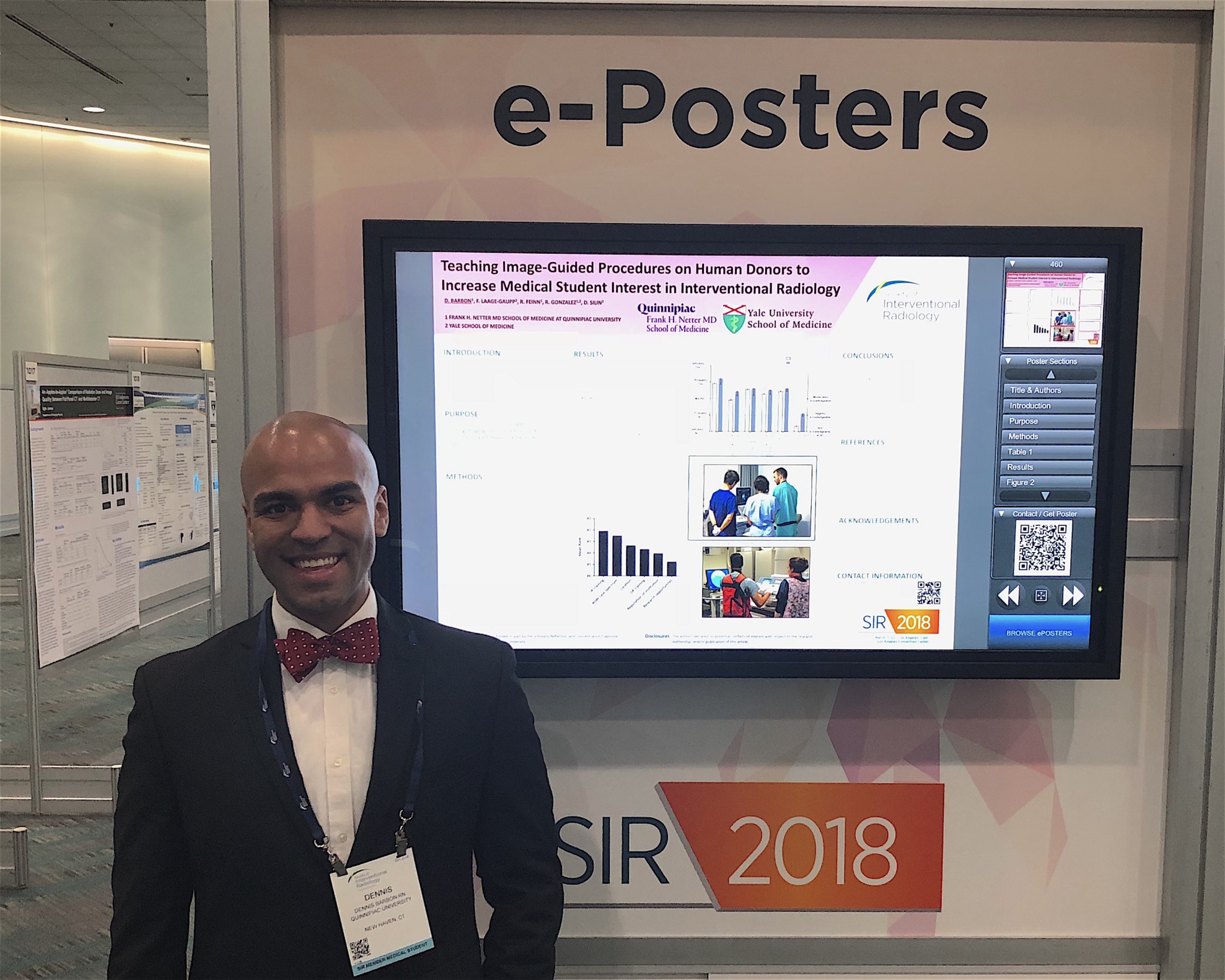 Dennis Barbon presenting at the Society of Interventional Radiology Annual Meeting 2018 in Los Angeles, CA
